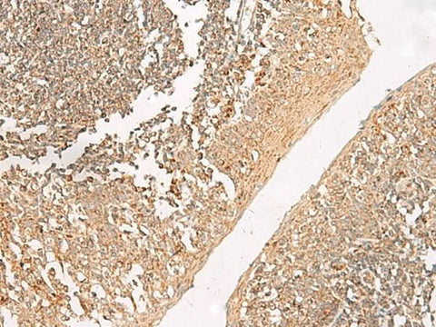Immunohistochemistry of paraffin-embedded Human tonsil tissue using GRIK5 Polyclonal Antibody at dilution of 1:35(×200)