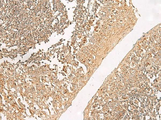 Immunohistochemistry of paraffin-embedded Human tonsil tissue using GRIK5 Polyclonal Antibody at dilution of 1:35(×200)