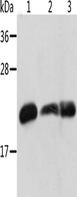 Anti-Human/Mouse/Rat CRYAB Antibody - ABMIUM