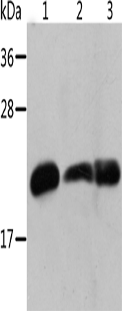 Anti-Human/Mouse/Rat CRYAB Antibody - ABMIUM
