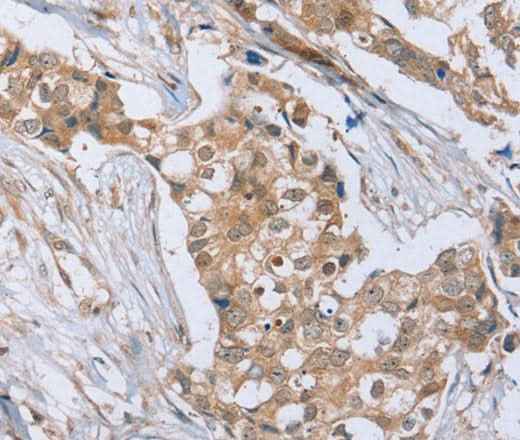 Anti-Human/Mouse/Rat RAB8B Antibody