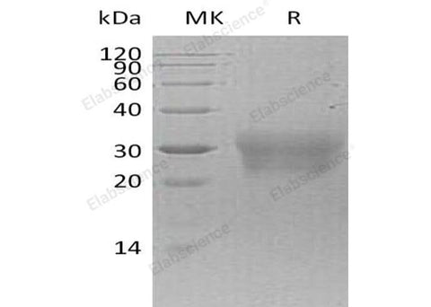 Recombinant Human NPDC-1/NPDC1 Protein (His Tag) - ABMIUM