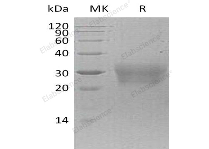 Recombinant Human NPDC-1/NPDC1 Protein (His Tag) - ABMIUM