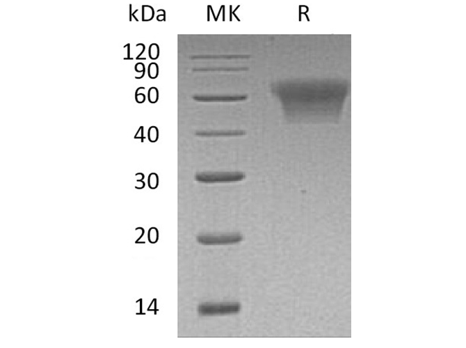 Recombinant Human CD55/DAF Protein (His Tag) - ABMIUM