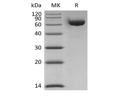 Recombinant Human LAG-3/CD223 (C-6His-Avi) Biotinylated - ABMIUM