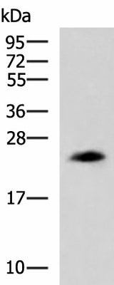 Western blot analysis of NIH/3T3 cell lysate using CLTB Polyclonal Antibody at dilution of 1:800