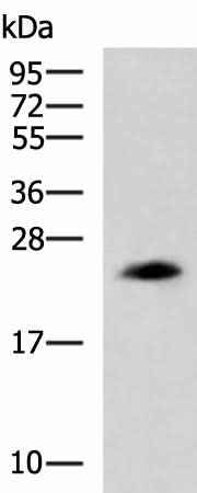 Anti-Human/Mouse CLTB Antibody