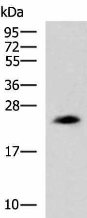 Western blot analysis of NIH/3T3 cell lysate using CLTB Polyclonal Antibody at dilution of 1:800