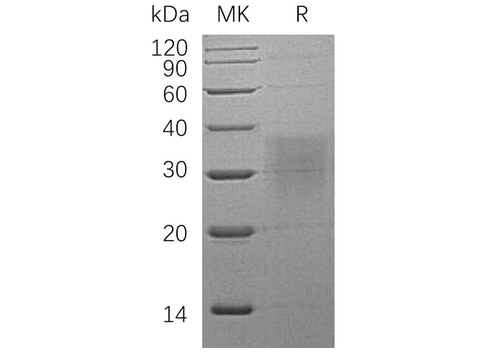 Recombinant Human BMPR2 Protein (His Tag) - ABMIUM