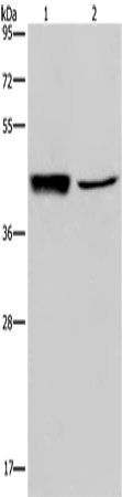 Anti-Human/Mouse/Rat GRPR Antibody - ABMIUM