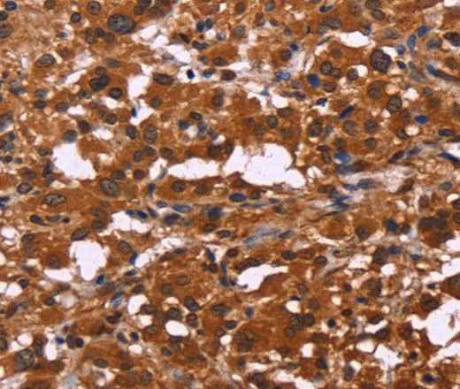 Anti-Human/Mouse ART5 Antibody
