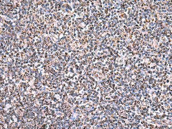Anti-Human HSF2BP Antibody