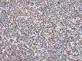 Immunohistochemistry of paraffin-embedded Human tonsil tissue using HSF2BP Polyclonal Antibody at dilution of 1:30(×200)