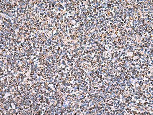 Anti-Human HSF2BP Antibody