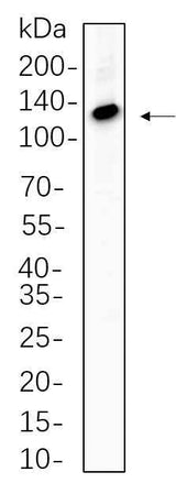 Anti-Human/Mouse/Rat ATP-Citrate Lyase Antibody [B784]