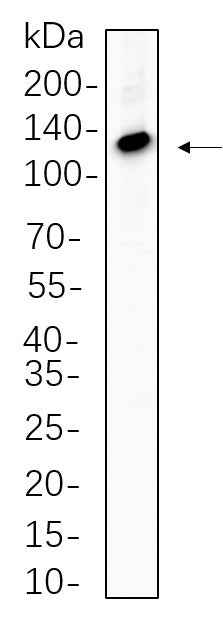 Anti-Human/Mouse/Rat ATP-Citrate Lyase Antibody [B784]