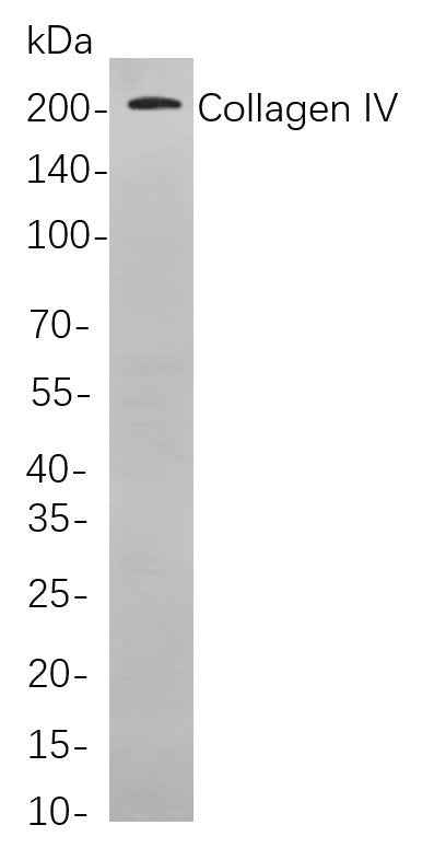 Anti-Human Collagen IV Antibody [B861] - ABMIUM