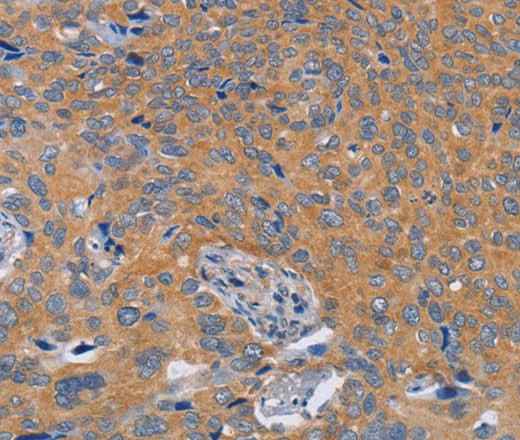 Anti-Human/Mouse/Rat BOD1 Antibody