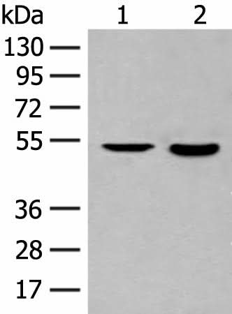 Western blot analysis of Jurkat cell and Human fetal brain tissue lysates using IL7R Polyclonal Antibody at dilution of 1:800