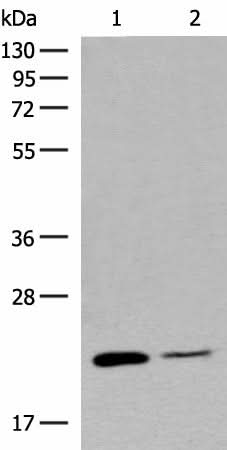 Western blot analysis of Human empty ileal tissue and Human ileum tissue lysates using RAC3 Polyclonal Antibody at dilution of 1:400