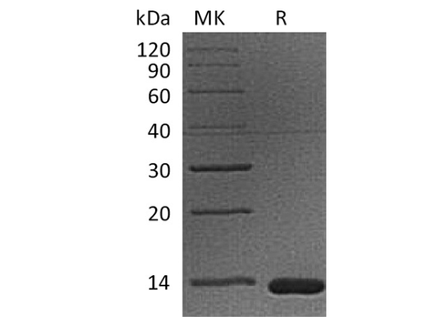 Recombinant Cynomolgus B2M/Beta-2-microglobulin Protein (His Tag) - ABMIUM