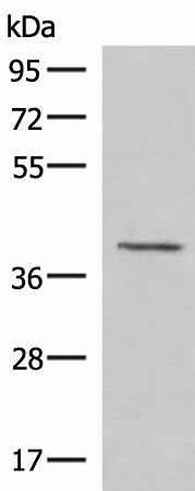 Western blot analysis of Human fetal brain tissue lysate using MECR Polyclonal Antibody at dilution of 1:1000