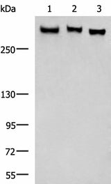 Anti-Human/Mouse/Rat FLNC Antibody - ABMIUM