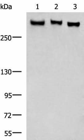 Anti-Human/Mouse/Rat FLNC Antibody - ABMIUM
