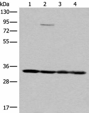 Western blot analysis of K562 HEPG2 231 and Jurkat cell lysates using MRPL1 Polyclonal Antibody at dilution of 1:350