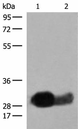 Western blot analysis of Raji cell Human spleen tissue lysates using HLA-DRB1 Polyclonal Antibody at dilution of 1:550
