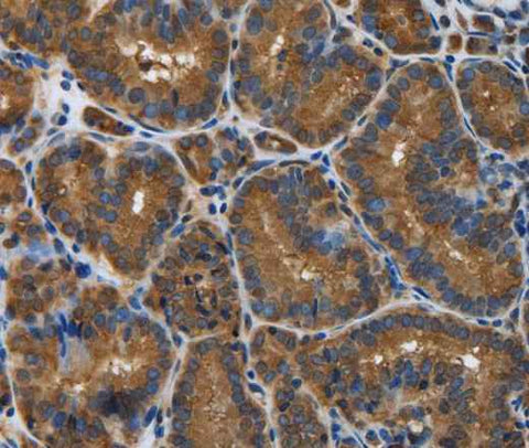 Anti-Human SNCG Antibody