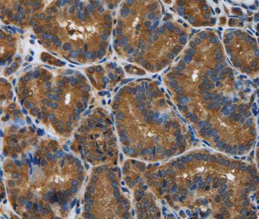 Anti-Human SNCG Antibody