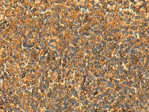 Immunohistochemistry of paraffin-embedded Human tonsil tissue using HS1BP3 Polyclonal Antibody at dilution of 1:50(×200)