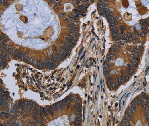 Anti-Human/Mouse/Rat FGF18 Antibody