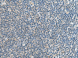 Immunohistochemistry of paraffin-embedded Human tonsil tissue using CNTN4 Polyclonal Antibody at dilution of 1:65(×200)