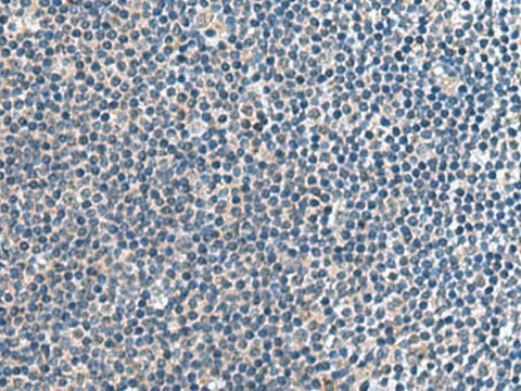 Immunohistochemistry of paraffin-embedded Human tonsil tissue using CNTN4 Polyclonal Antibody at dilution of 1:65(×200)