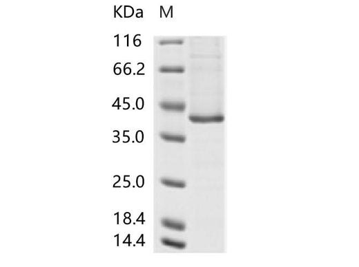 > 90 % as determined by reducing SDS-PAGE.