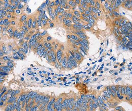 Anti-Human/Mouse/Rat MTOR Antibody