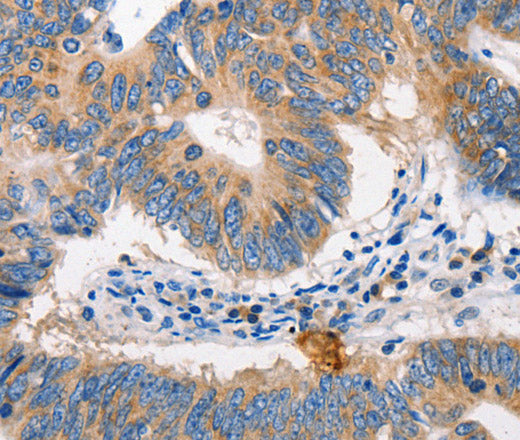 Anti-Human/Mouse/Rat MTOR Antibody - ABMIUM