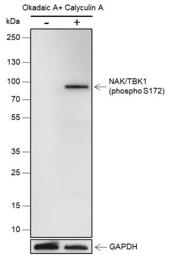 Anti-Human/Rat Phospho-TBK1/NAK (Ser172) Antibody [A843] - ABMIUM