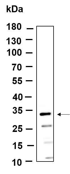 Anti-Human/Mouse/Rat MTX3 Antibody [B972] - ABMIUM