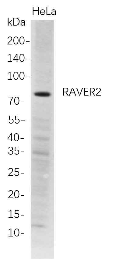 Anti-Human RAVER2 Antibody [B696] - ABMIUM