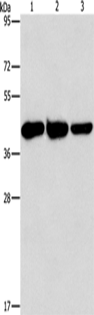 Anti-Human/Mouse/Rat GOT1 Antibody - ABMIUM