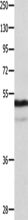 Anti-Human/Mouse/Rat NAP1L1 Antibody - ABMIUM