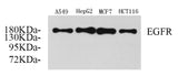 Western Blot analysis of various samples using EGFR Polyclonal Antibody at dilution of 1:750.
