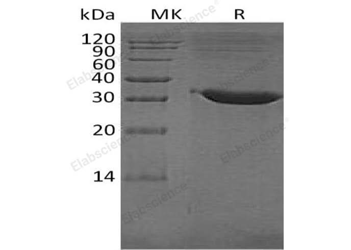 Recombinant Human Tryptase β-2/TPSB2 Protein (His Tag) - ABMIUM