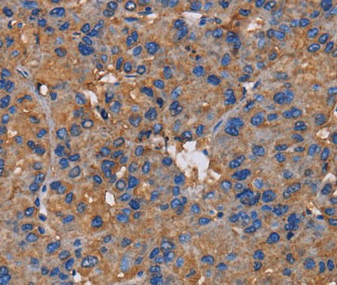 Anti-Human/Mouse/Rat NCSTN Antibody - ABMIUM