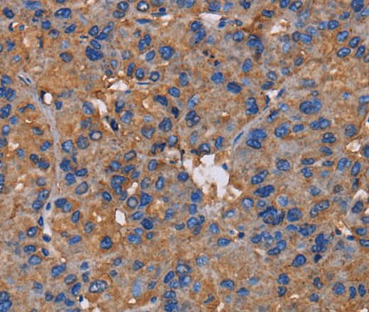 Anti-Human/Mouse/Rat NCSTN Antibody - ABMIUM