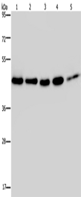 Anti-Human/Mouse/Rat HSP40-4 Antibody - ABMIUM