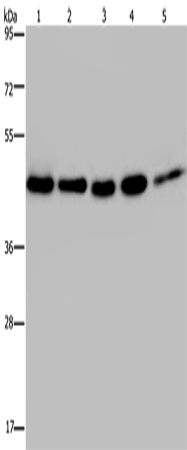 Anti-Human/Mouse/Rat HSP40-4 Antibody - ABMIUM